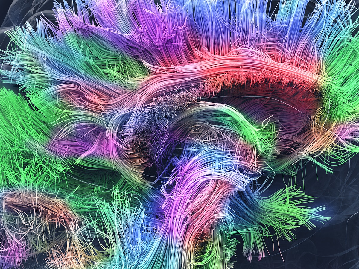 Mulitcolor brain connectomics Shutterstock 622433543
